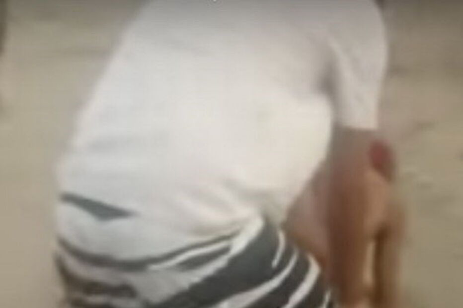 Jovem fica sem pénis após ataque de tubarão