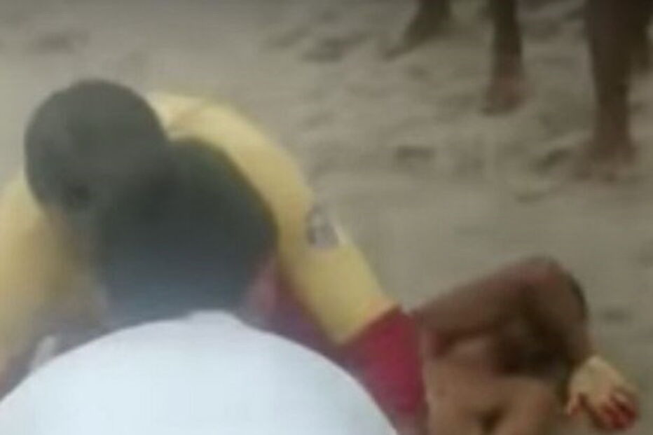 Jovem fica sem pénis após ataque de tubarão