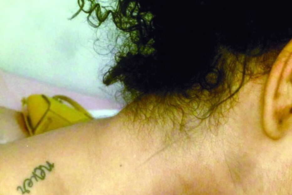 Marcas de agressões