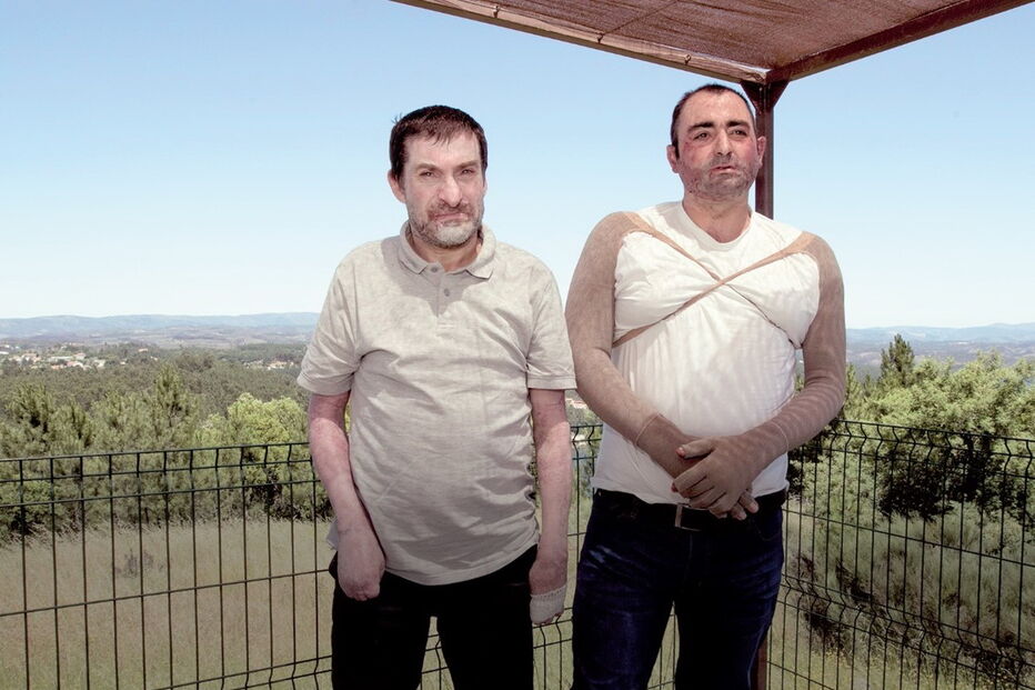 Vítor Neves e José Carlos Santos sofreram queimaduras graves em Pedrógão Grande