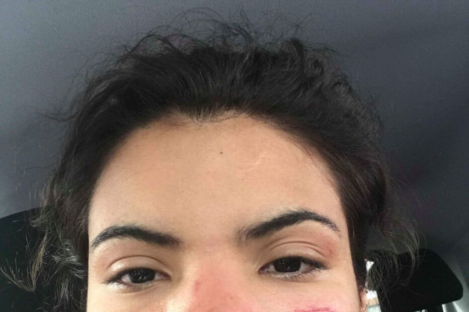 Jovem colombiana agredida por segurança no Porto