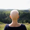 Cientistas descobrem como travar queda de cabelo em doentes com cancro que fazem quimioterapia