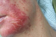 Mag's Murphys Journey