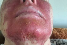 Mag's Murphys Journey