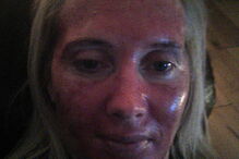 Mag's Murphys Journey