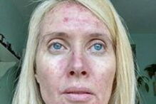 Mag's Murphys Journey