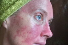 Mag's Murphys Journey