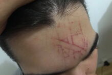 Duarte, vítima de agressões em Coimbra