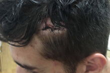 Duarte, vítima de agressões em Coimbra