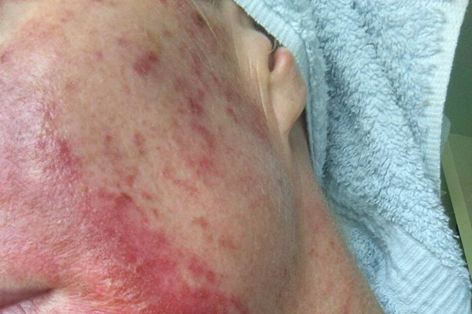 Mag's Murphys Journey