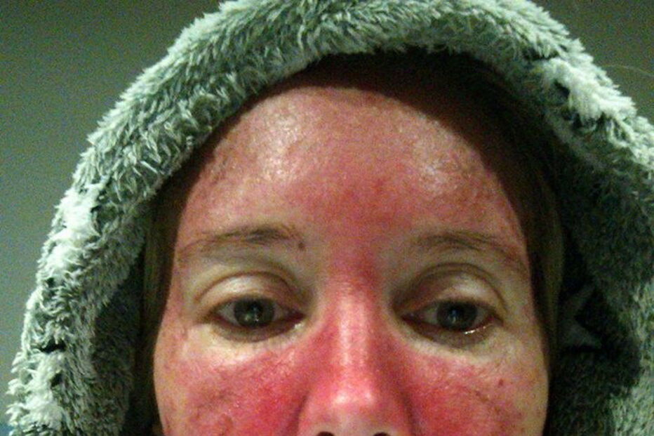 Mag's Murphys Journey