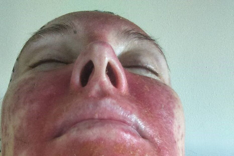 Mag's Murphys Journey