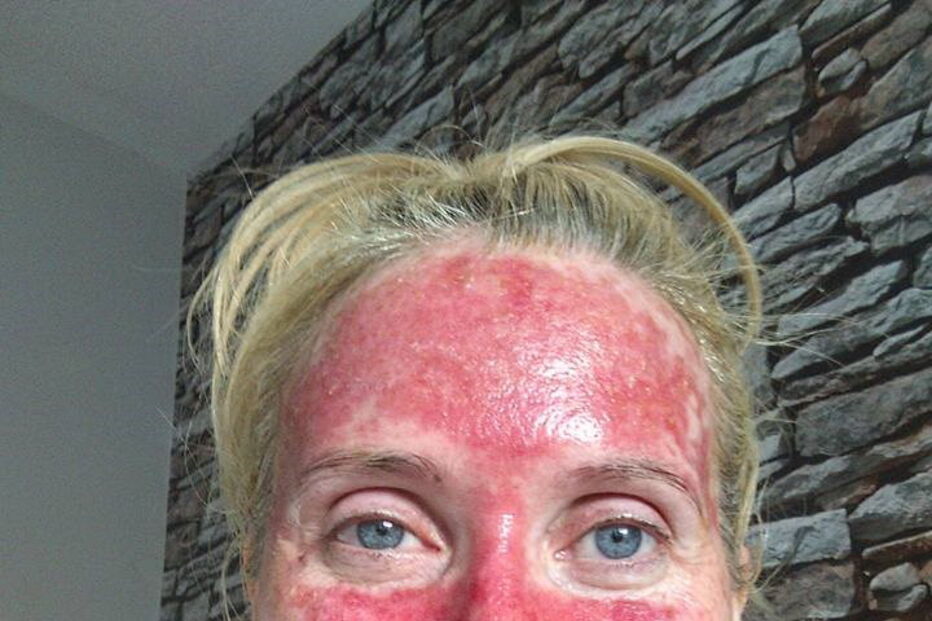 Mag's Murphys Journey