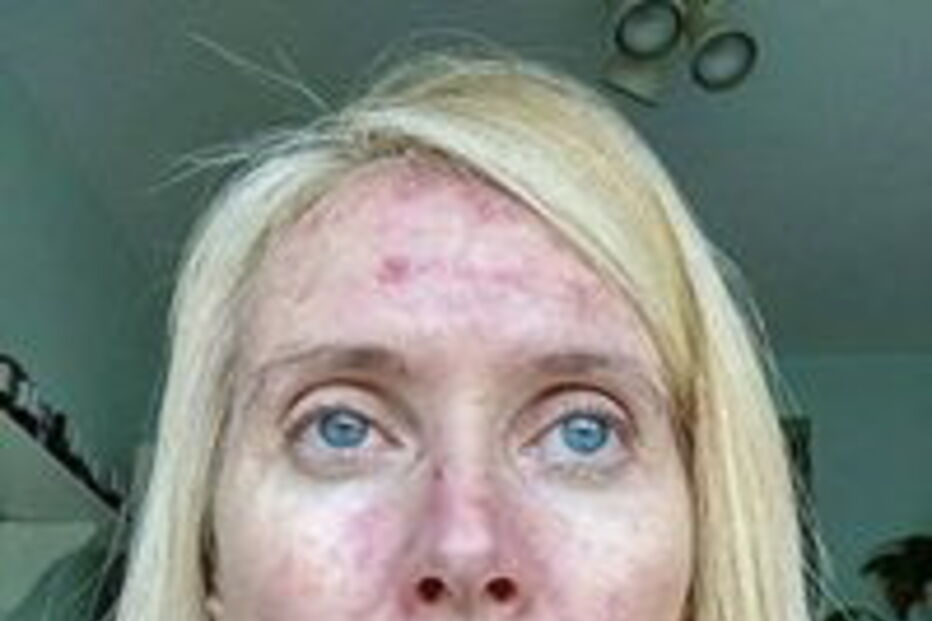 Mag's Murphys Journey