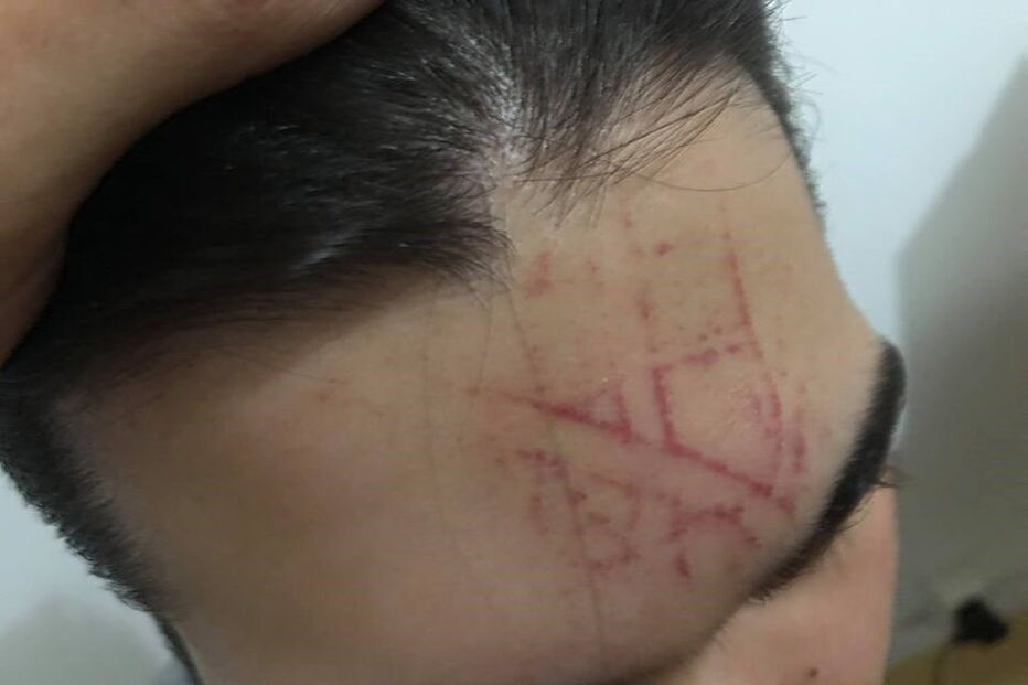 Duarte, vítima de agressões em Coimbra