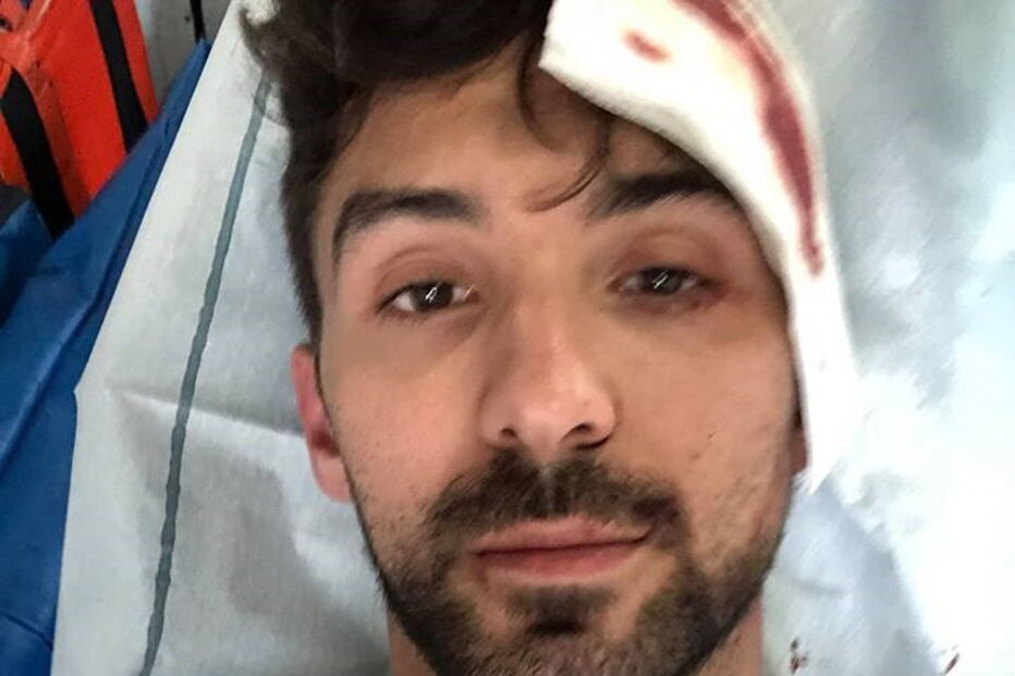 Duarte, vítima de agressões em Coimbra