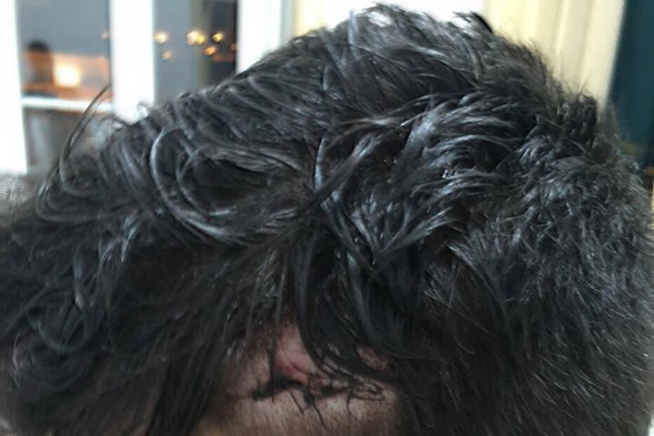 Duarte, vítima de agressões em Coimbra