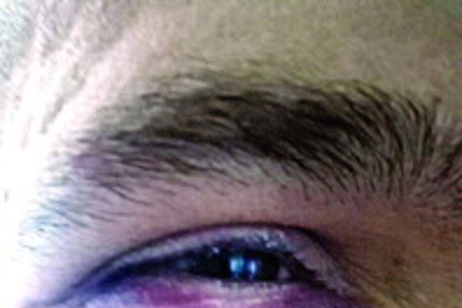 Miitar da GNR ferido depois de agressão de condutor