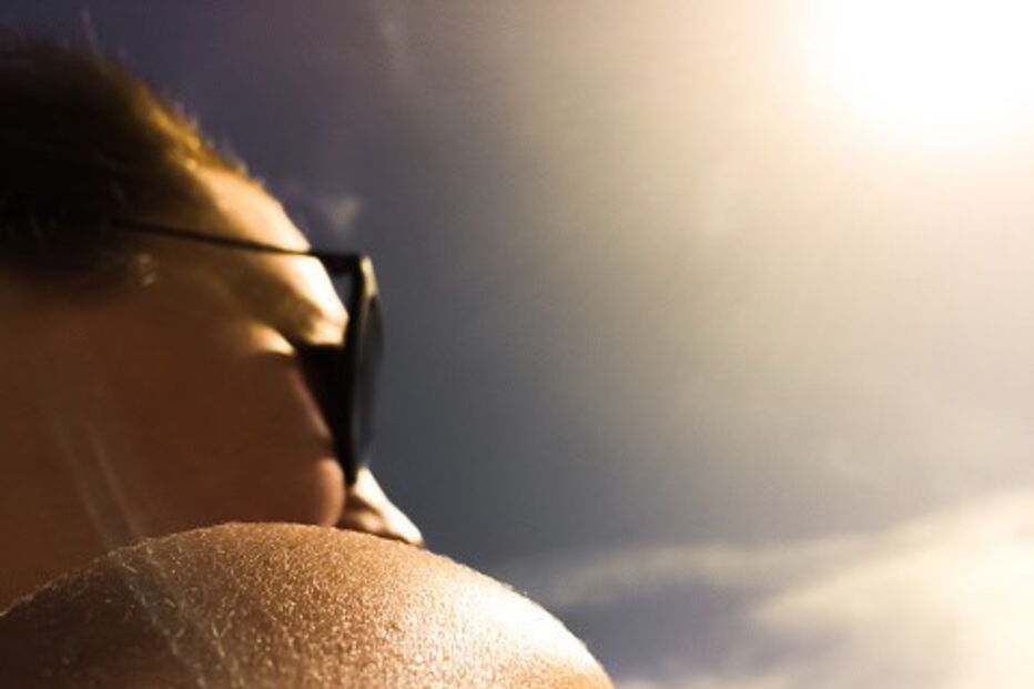 Madeira e Açores em risco muito elevado de exposição aos raios UV