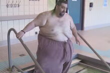 Homem cujo escroto não pára de crescer não faz sexo há nove anos