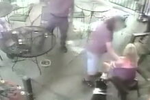 Ex-modelo precisa de cirurgia estética após ser mordida por cão