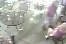 Ex-modelo precisa de cirurgia estética após ser mordida por cão