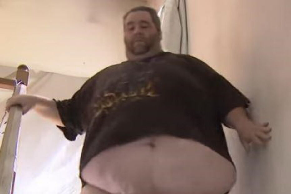 Homem cujo escroto não pára de crescer não faz sexo há nove anos