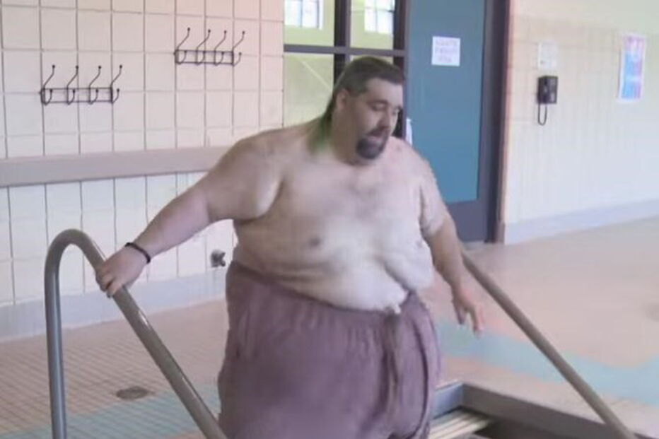 Homem cujo escroto não pára de crescer não faz sexo há nove anos