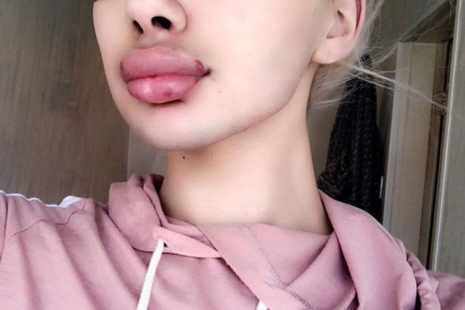 Kairah Kelly, jovem transgénero britânica