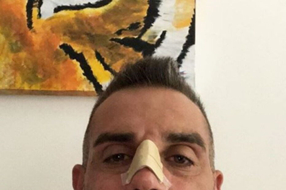 Stefano Sorrentino parte o nariz ao chocar contra Ronaldo