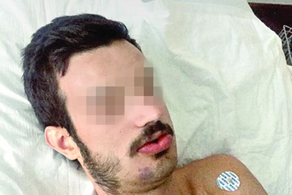 Jovem agredido em noite de diversão em Vilamoura