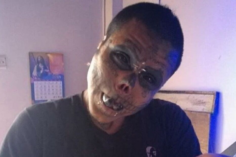 Homem arranca nariz e orelhas para ficar parecido com um esqueleto