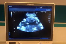 Rita Pereira mostra ecografia do primeiro filho