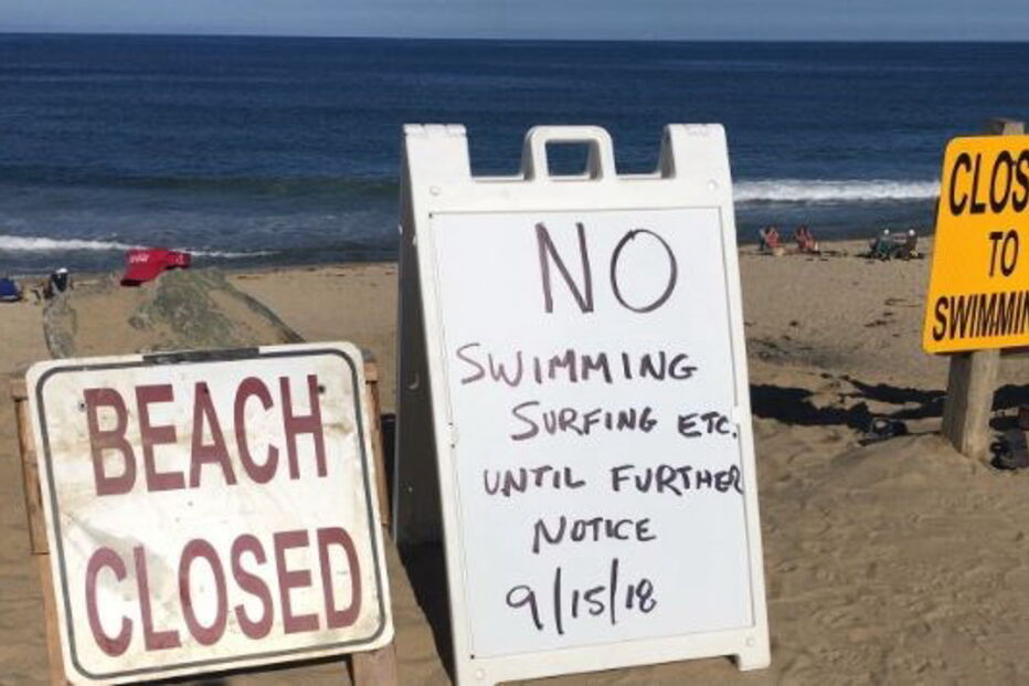 Ataque de tubarão mata jovem nos Estados Unidos