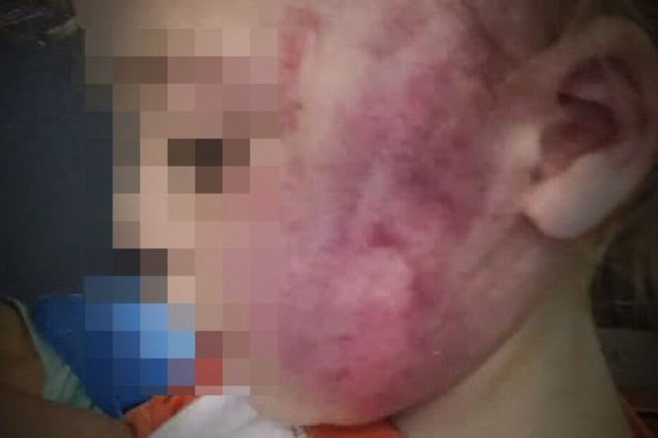 Bebé torturado pelo padrasto em Vila Franca de Xira