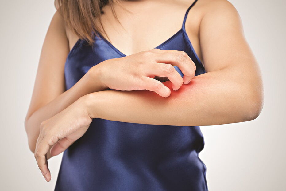 Comichão permanente acaba por levar o doente a fazer feridas na pele. A doença não é contagiosa 