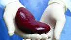 Cientistas anunciam sucesso em transplante de rins de porco para corpo humano