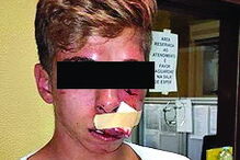 Vítima tem 17 anos e ficou sozinha no local 