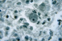 A ameba Naegleria fowleri