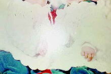 Gémeas Tânia e Magda Fernandes nasceram coladas pelo abdómen há 40 anas. Operação deu-lhes vida normal