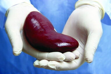 Transplante renal