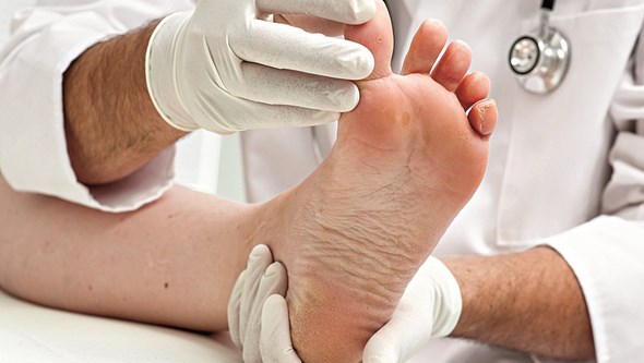 Unhas encravadas: cirurgia resolve problema nos pés