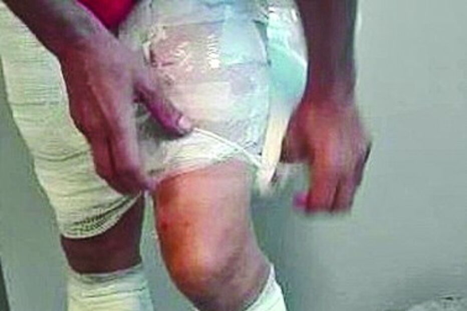 Droga enrolada nas pernas  