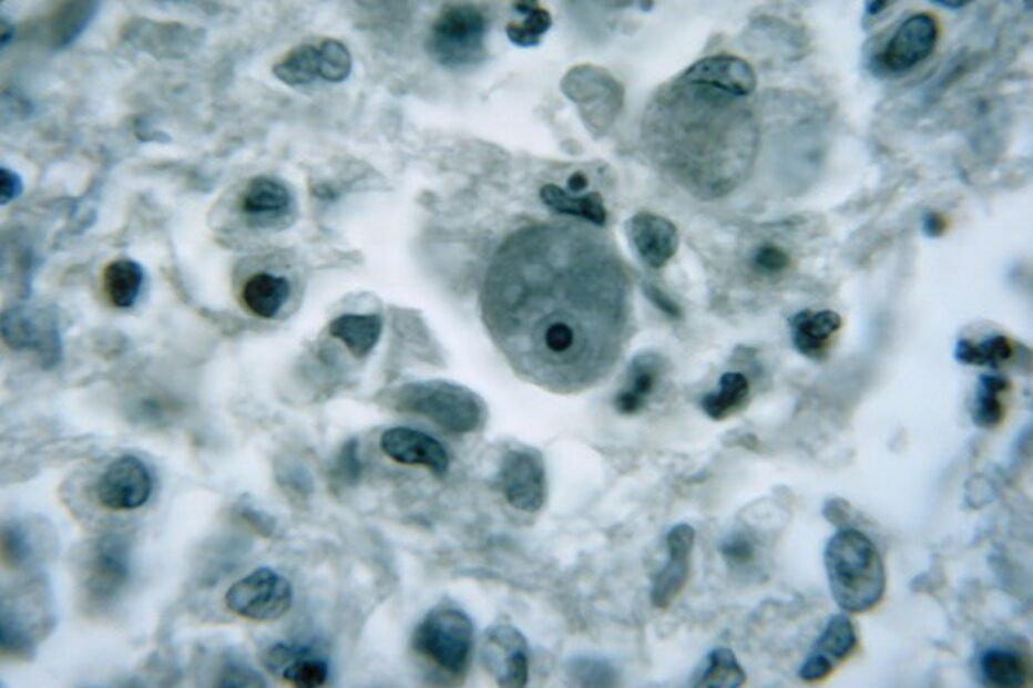 A ameba Naegleria fowleri