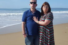 Casal que não consegue sorrir devido a doença rara apaixona-se na internet