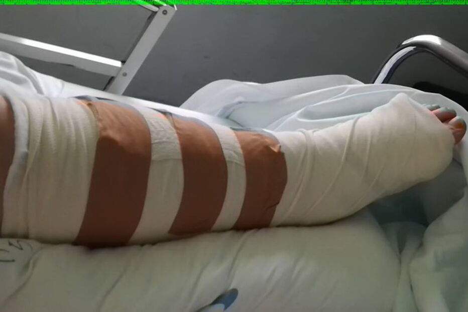 Carla Costa sofreu fratura no tornozelo após ser agredida em Vila Nova de Famalicão