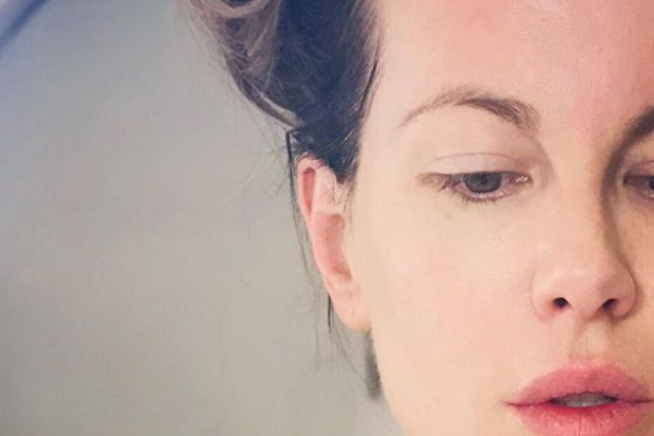 Kate Beckinsale após o tratamento de pele
