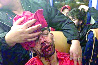 Bruno Simões após o incidente