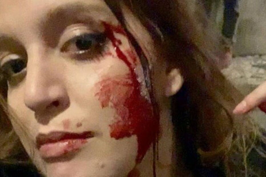 Sophia Velho queixa-se de ter sido agredida em Lisboa