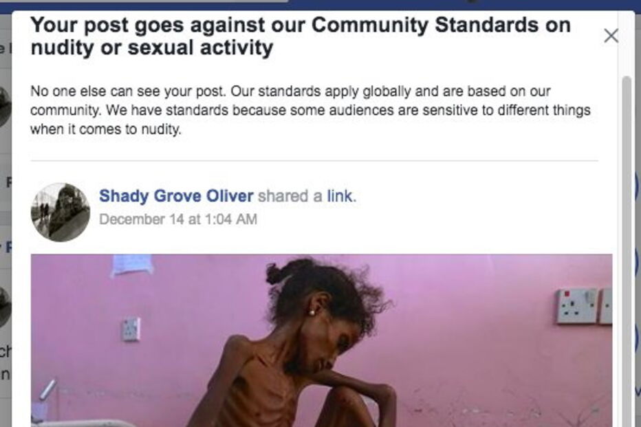 Facebook censura imagens de crianças subnutridas no Iémen por conterem 